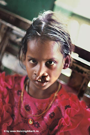 Fotoalbum Friends of Padhar e.V.